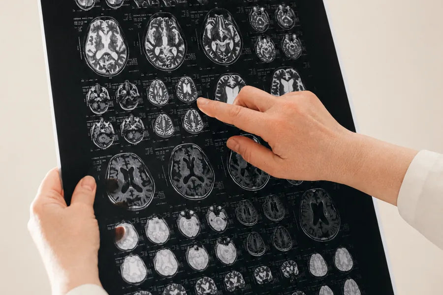 Hands reviewing brain scan imagery.